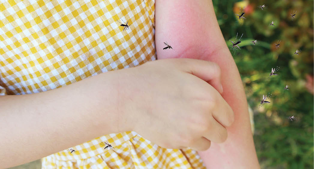 Little girl has skin rash allergy and itchy on her arm from mosquito bite